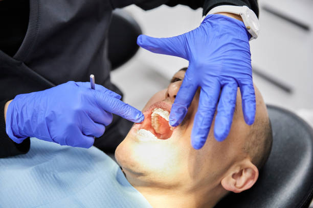 Best Emergency Dental Care for Abscessed Tooth in Rden, WA